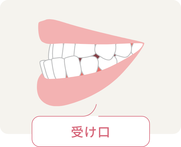 受け口