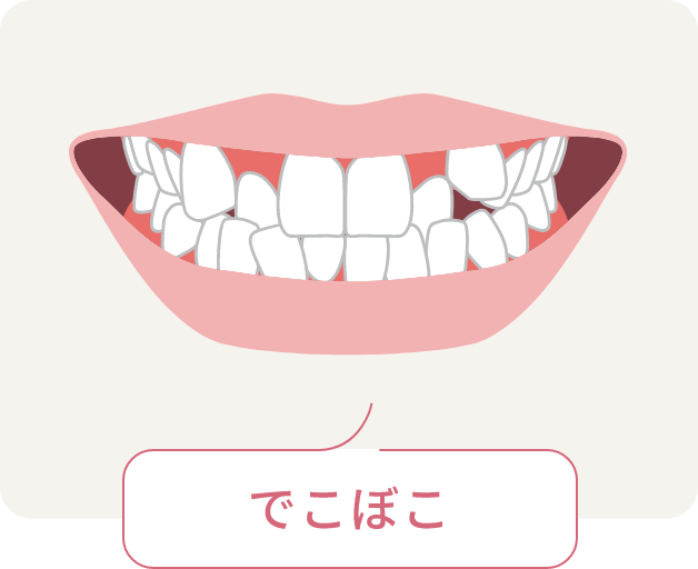 でこぼこ