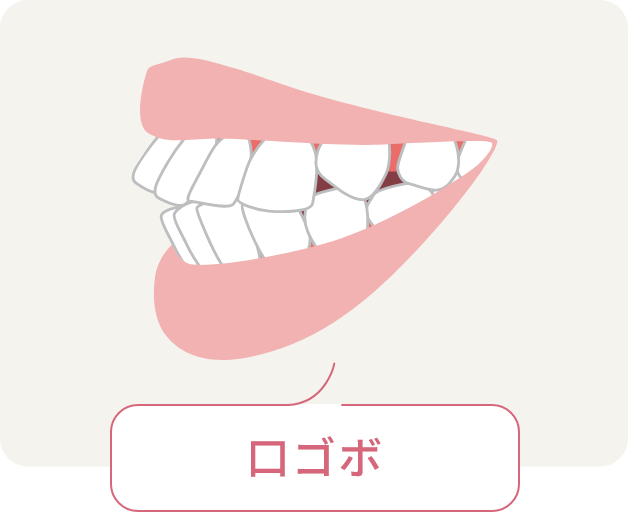 口ゴボ
