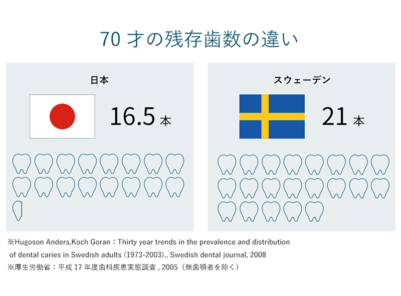 70歳の残存歯数の違い：日本は平均16.5本、スウェーデンは平均21本