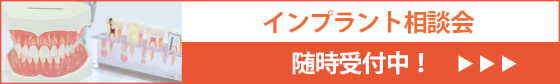 インプラント相談会　随時実施中！